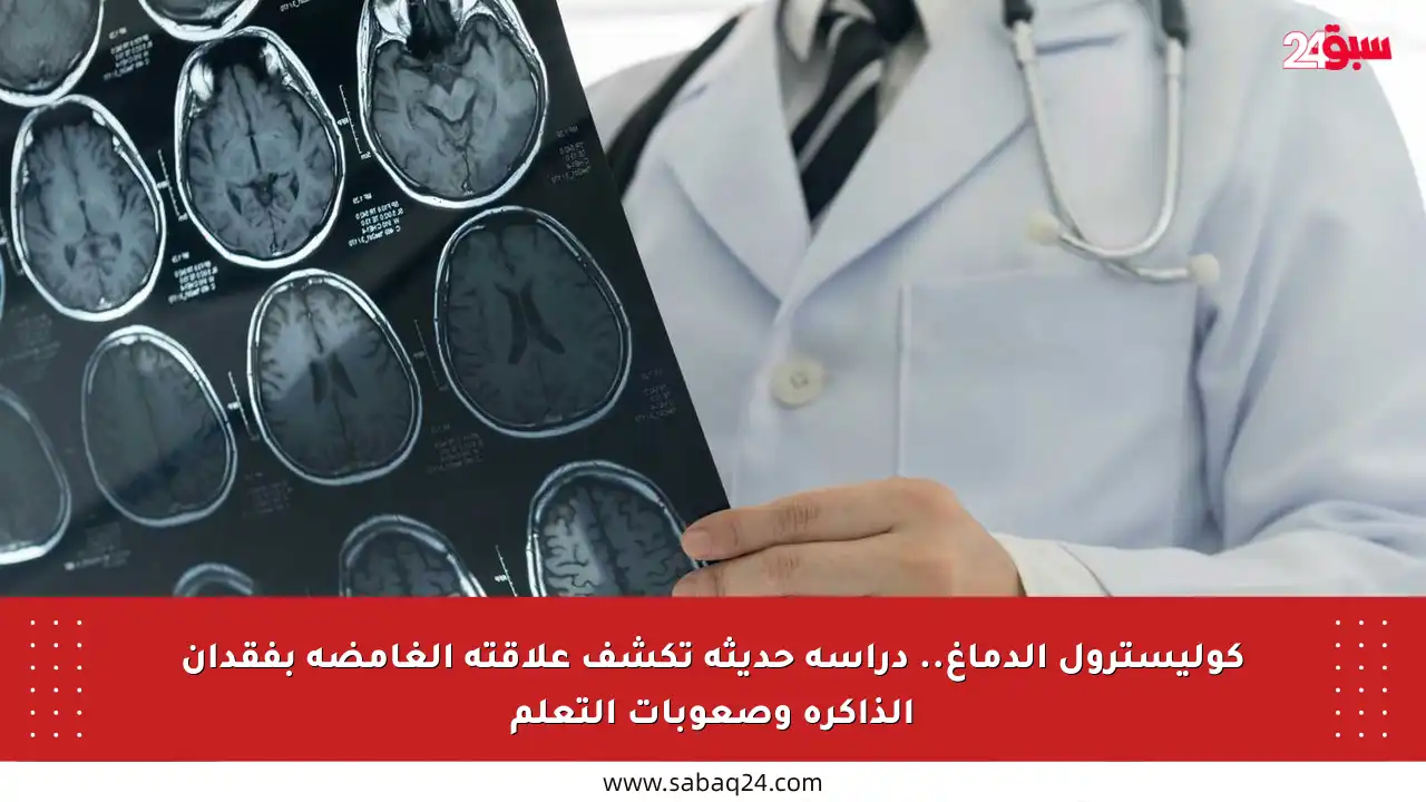 كوليسترول الدماغ.. دراسة حديثة تكشف علاقته الغامضة بفقدان الذاكرة وصعوبات التعلم
